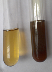 alcaptonuria urine